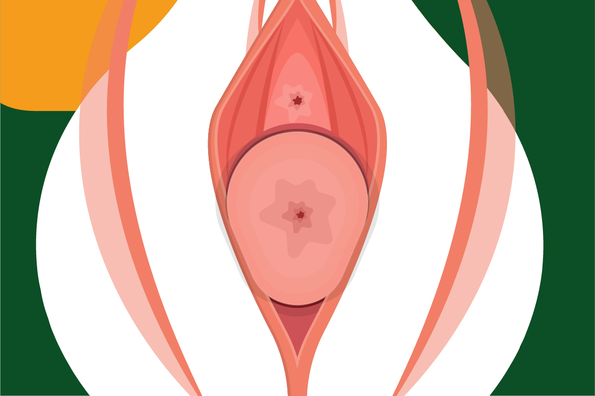 Le traitement du prolapsus génital : solutions pour restaurer l’équilibre pelvien